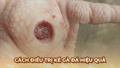 Điều trị ké gà đá: Cách nhận biết và chữa trị hiệu quả